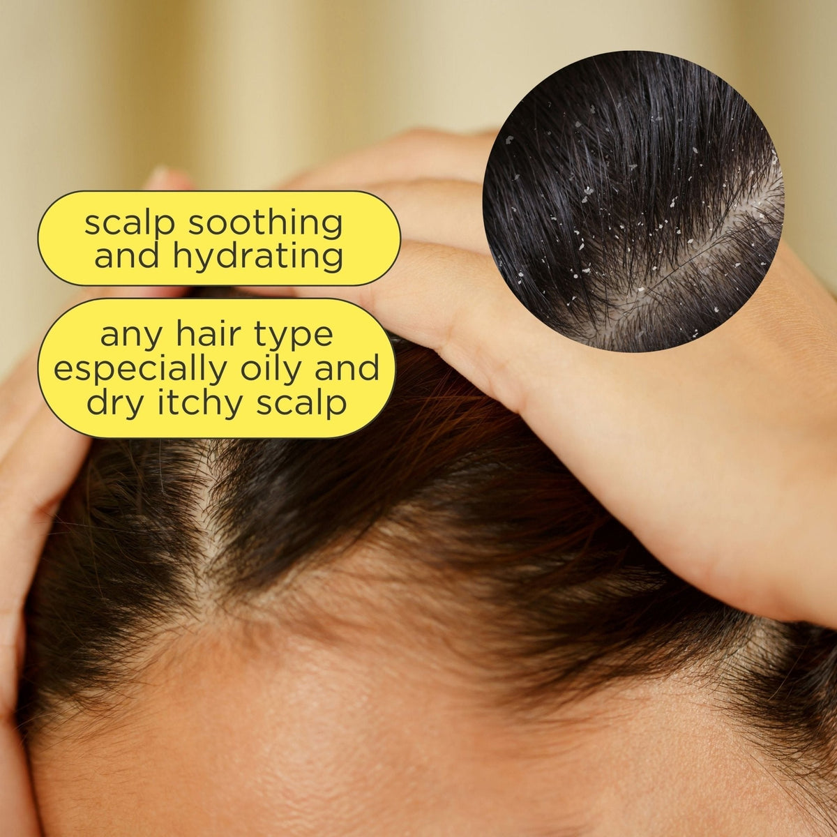 Scalp Love Daily Scalp Refresher Rosemary Mint
